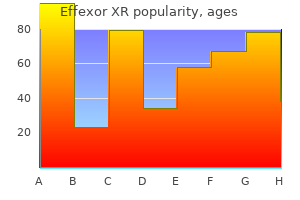 effexor xr 150mg fast delivery