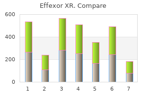 order 150mg effexor xr overnight delivery