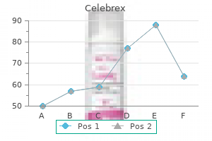 cheap 100mg celebrex visa