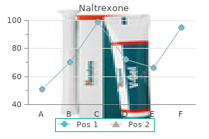 discount 50mg naltrexone visa